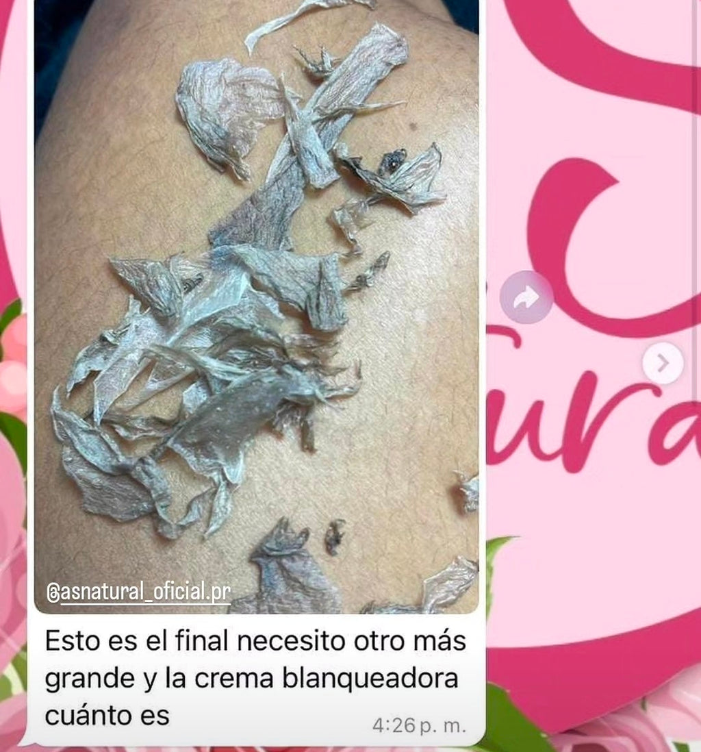 KIT BASICO 4 PASOS
