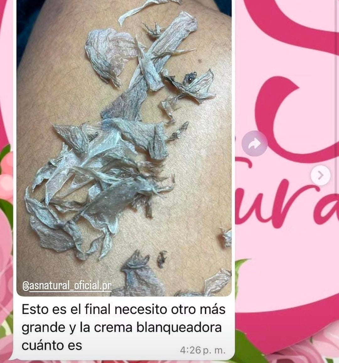 KIT BASICO 4 PASOS