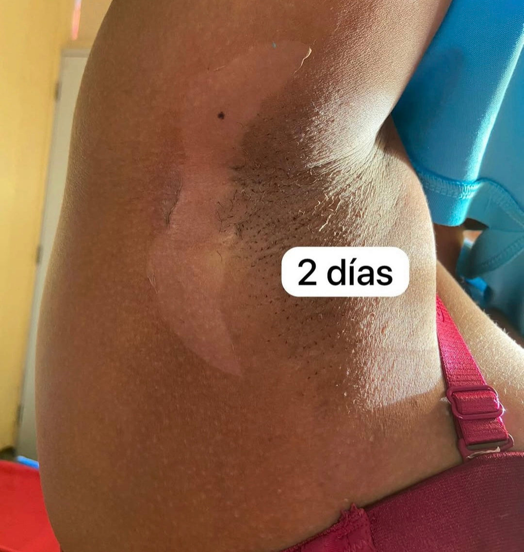 KIT BASICO 4 PASOS