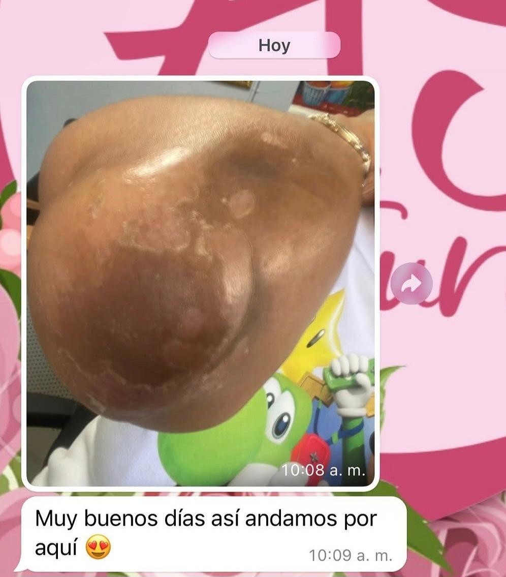 KIT BASICO 4 PASOS