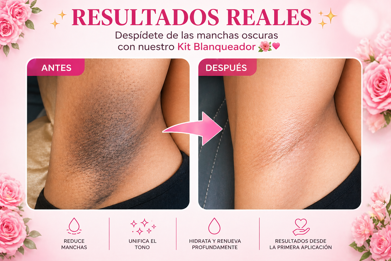 KIT BASICO 4 PASOS