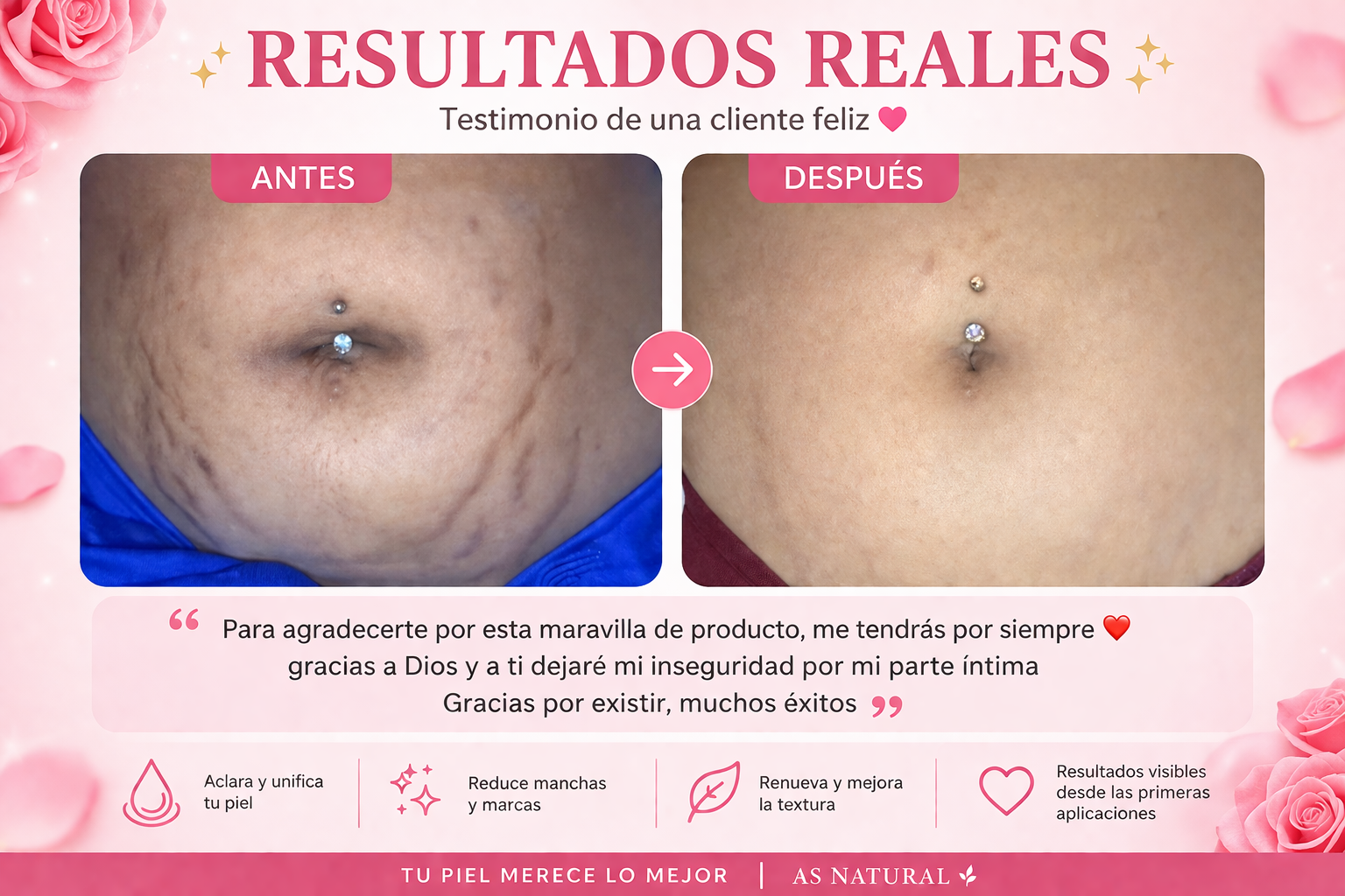KIT BASICO 4 PASOS